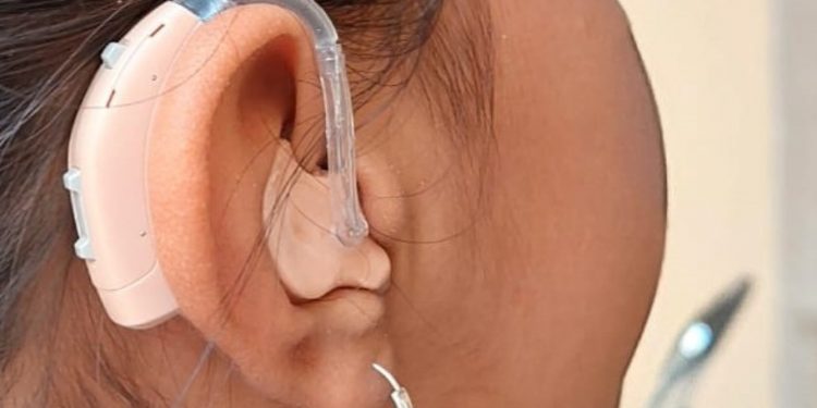 INICIA SMDIF LOS CABOS REGISTRO PARA LA ENTREGA DE APARATOS AUDITIVOS  MEDIANTE EL PROGRAMA “PONTE OREJA” DE LA FUNDACIÓN MVS RADIO