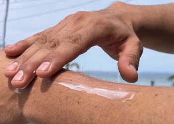 ADVIERTE IMSS BCS SOBRE DAÑOS IRREVERSIBLES  EN LA PIEL POR EXPOSICIÓN AL SOL SIN PROTECCIÓN