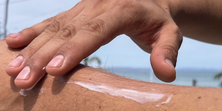 ADVIERTE IMSS BCS SOBRE DAÑOS IRREVERSIBLES  EN LA PIEL POR EXPOSICIÓN AL SOL SIN PROTECCIÓN