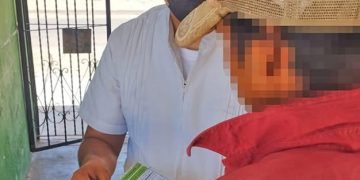 CONFIRMA SALUD ESTATAL TRES CASOS IMPORTADOS DE SARAMPIÓN EN CIUDAD INSURGENTES