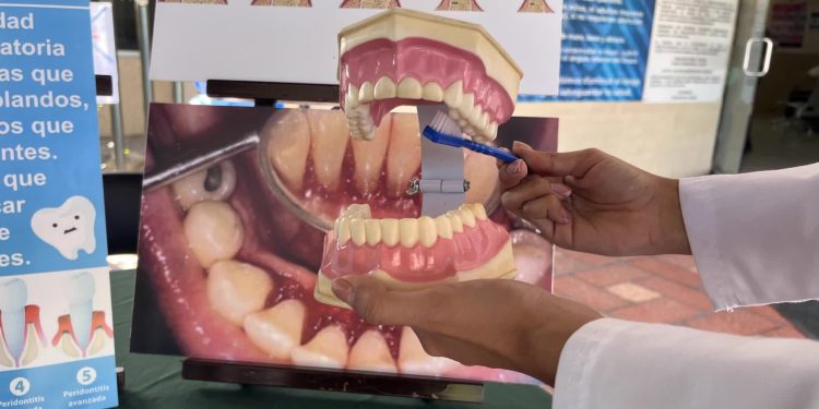 IMSS BAJA CALIFORNIA SUR INVITA A FORTALECER AUTOCUIDADO DE SALUD BUCAL EN PERIODO VACACIONAL